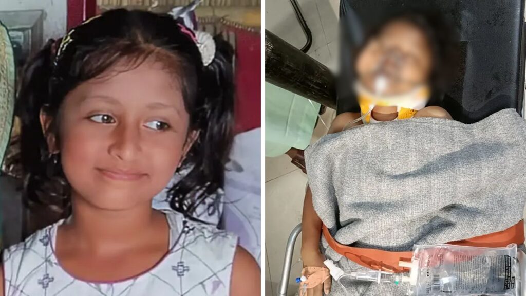 লাইফ সাপোর্টে টেকনাফে গুলিবিদ্ধ শিশু হুজাইফা, চিকিৎসক যা জানালেন